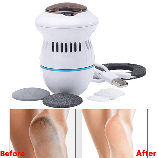 Automatic Electric Foot Pedicure Grinder & Callus Remover Tool⁠